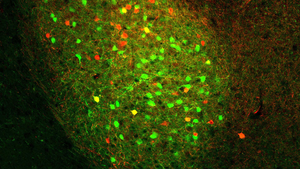 The basolateral amygdala