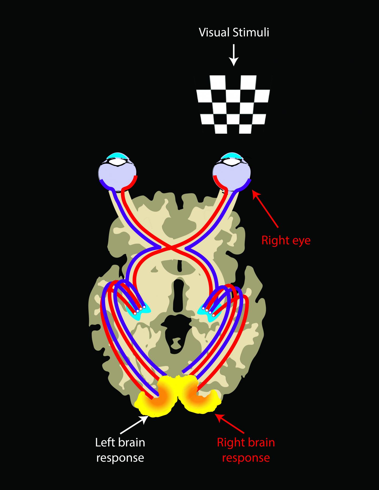 Symmetrical Brain Response