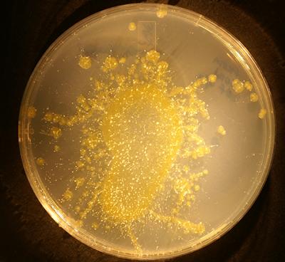 Farmer Amoeba Growing Bacteria