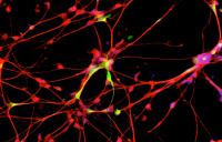 Dopamine-Producing Brain Cells