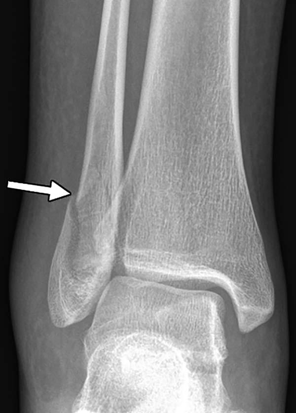 Radiologists Can Help Identify Victims of Domestic Violence