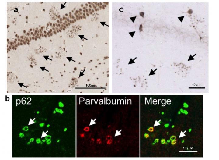 Degenerating Interneurons in Frontotemporal Lobar Degeneration (FTLD) Mice