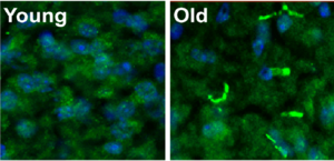 Brain images of old and young mice