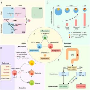 Schematic diagram of the SPP1+ macrophage model in CRC.