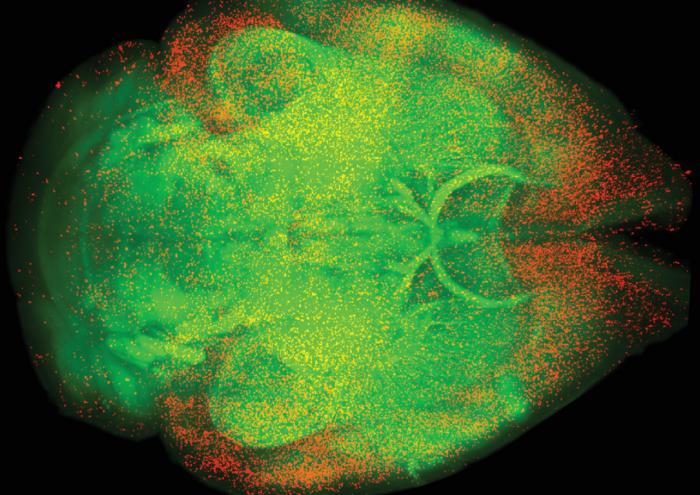 Oxycodone-induced Brain Activity