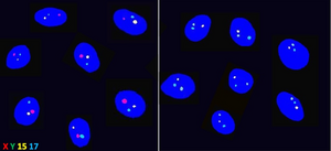 A non-randomized clinical trial to determine the safety and efficacy of a novel sperm sex selection technique