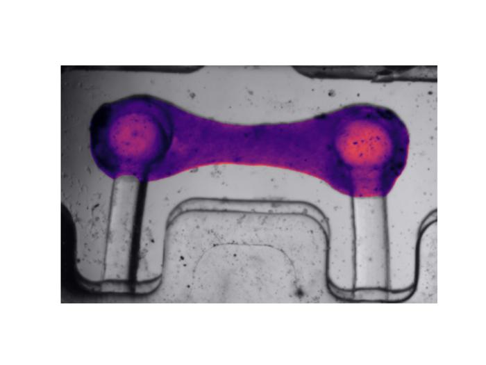 BeatProfiler - a transformative new tool to study and diagnose heart function