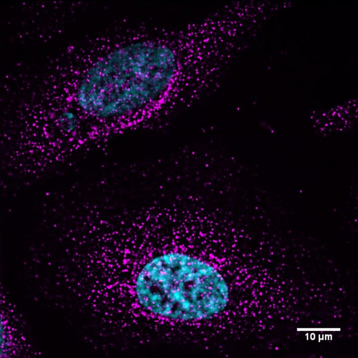 Myosin VI in Human Cells