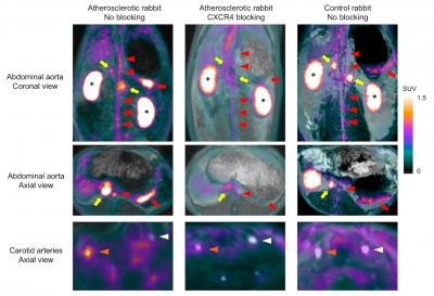 Ga-68-Pentixafor Uptake in Rabbits Using a PET-MRI System