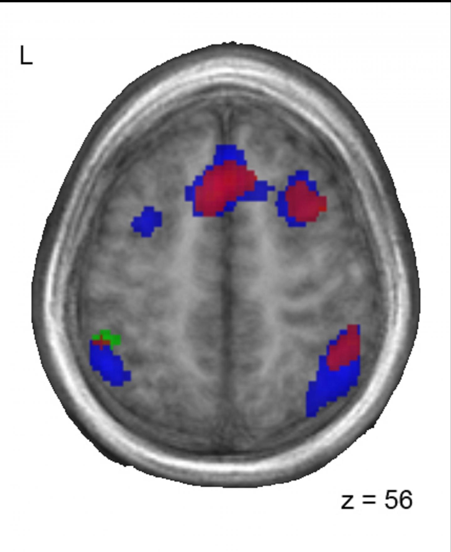 Similarity in Brain Activation