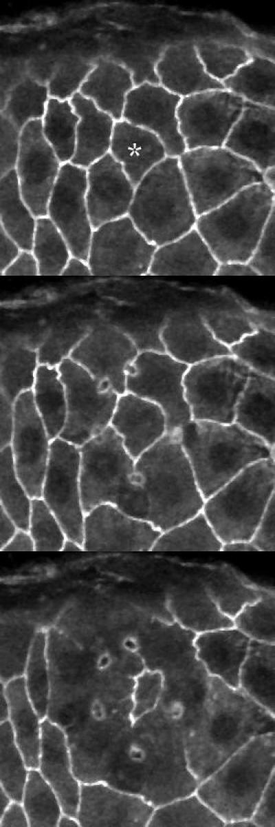 Holographic UV Laser Microsurgery