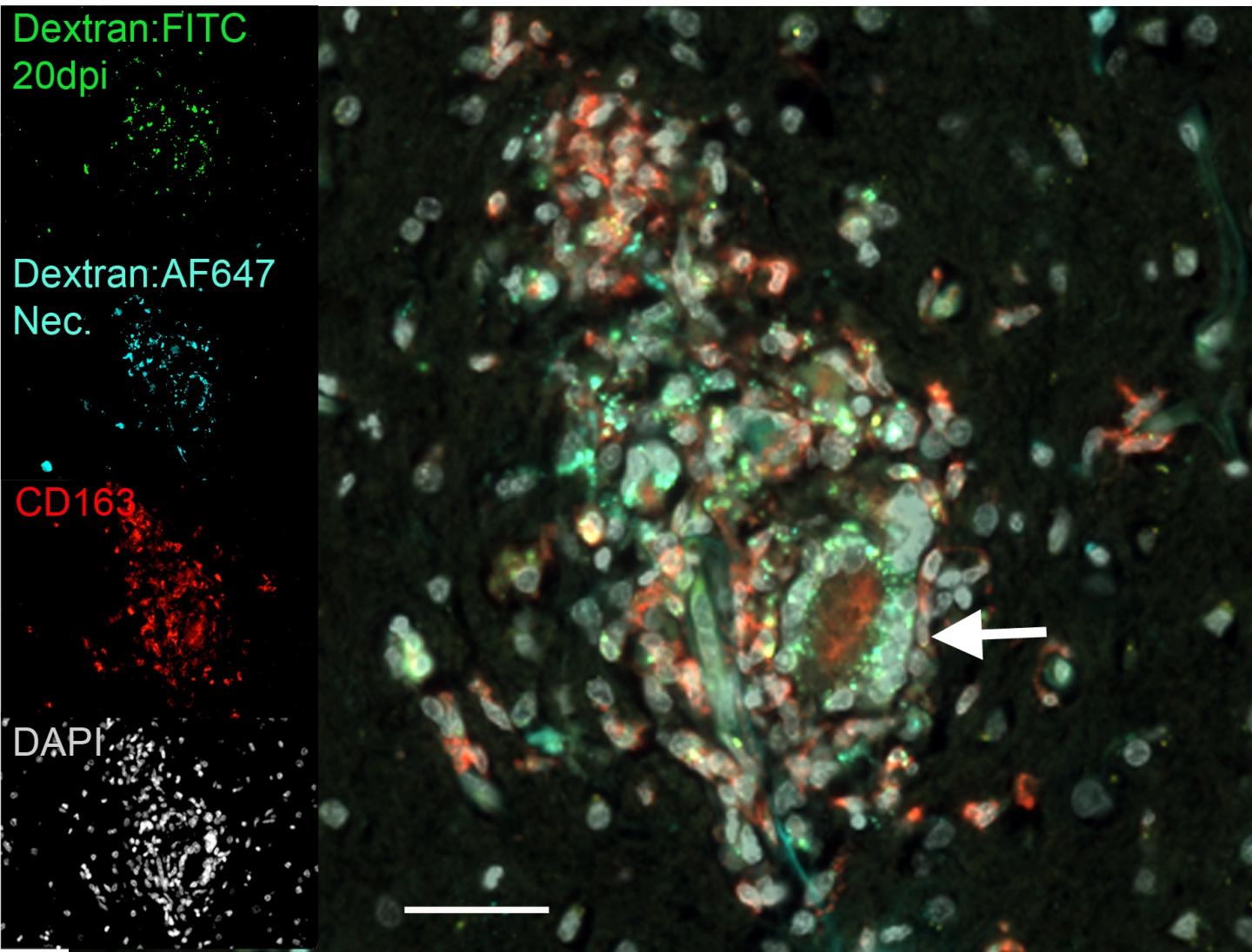 Caustic Role of Disease-Fighting Cells in HIV Infection