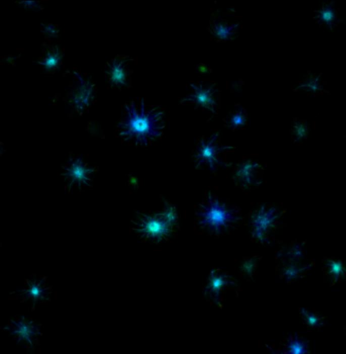 Fluorescence lifetime micrographs of a fluorescently tagged human protein inside yeast cells