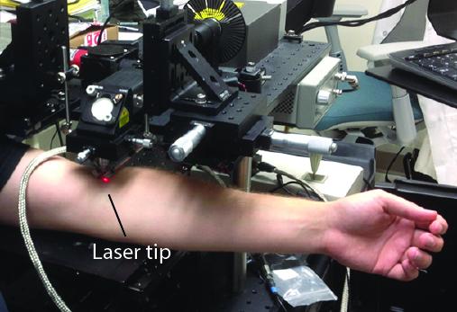 Sensitive, Noninvasive Platform Detects Circulating Tumor Cells in Melanoma Patients (1 of 2)