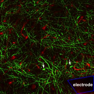 Oligodendrocyte and myelin