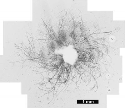 Microscopy Neurite Growth