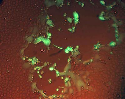 Equid Herpesvirus Type 1