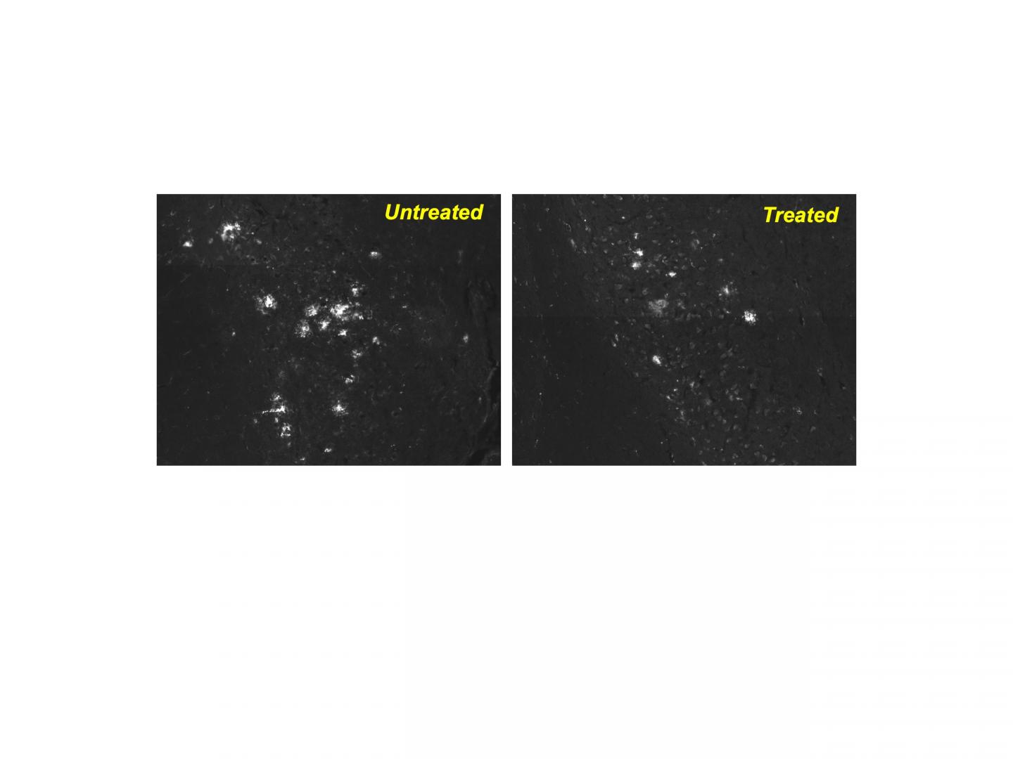 Effect of Drug CA on Alzheimer's in Mice