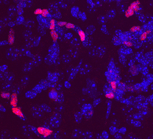 Single protein prompts mature brain cells to regenerate multiple cell types