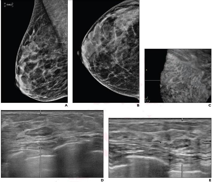 Routine screening for BI-RADS lesions on auto