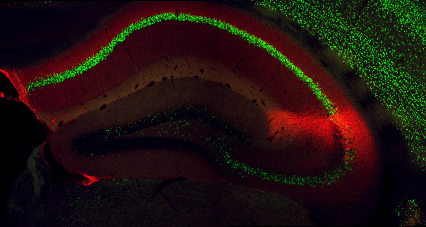 Hippocampus in Adult Mouse