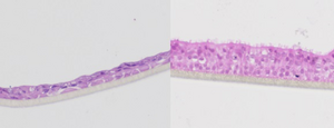 Diseased (left) and healthy (right) membrane slivers from a lung organoid