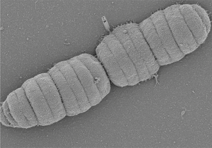 Scanning electron micrograph of the caterpillar-like bactrioid Simonsiella muelleri, up to 4 µm long (CC BY 4.0 Sammy Nyongesa and Frédéric Veyrier)