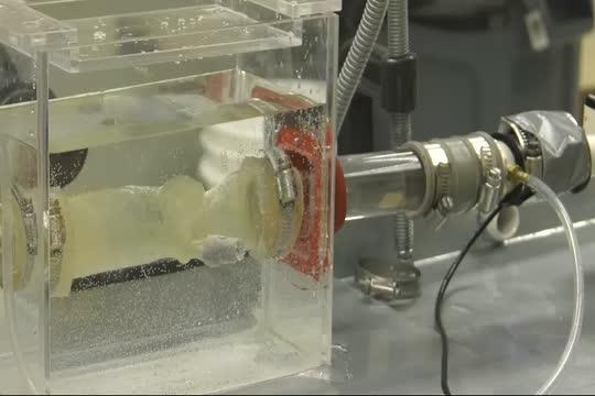 3D-Printed Aortas Advise Doctors on Best Choice for Heart Patients