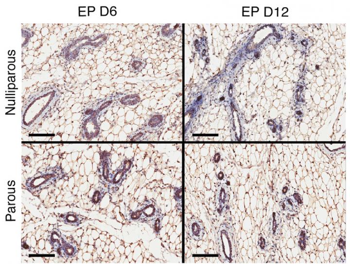 Prior Pregnancy Affects Milk P [IMAGE] | EurekAlert! Science News Releases