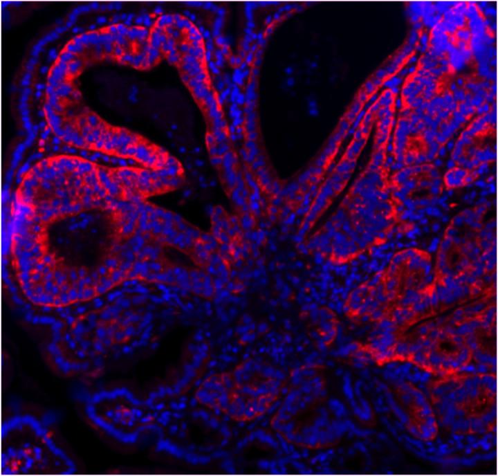 Culprit in Colon Cancer