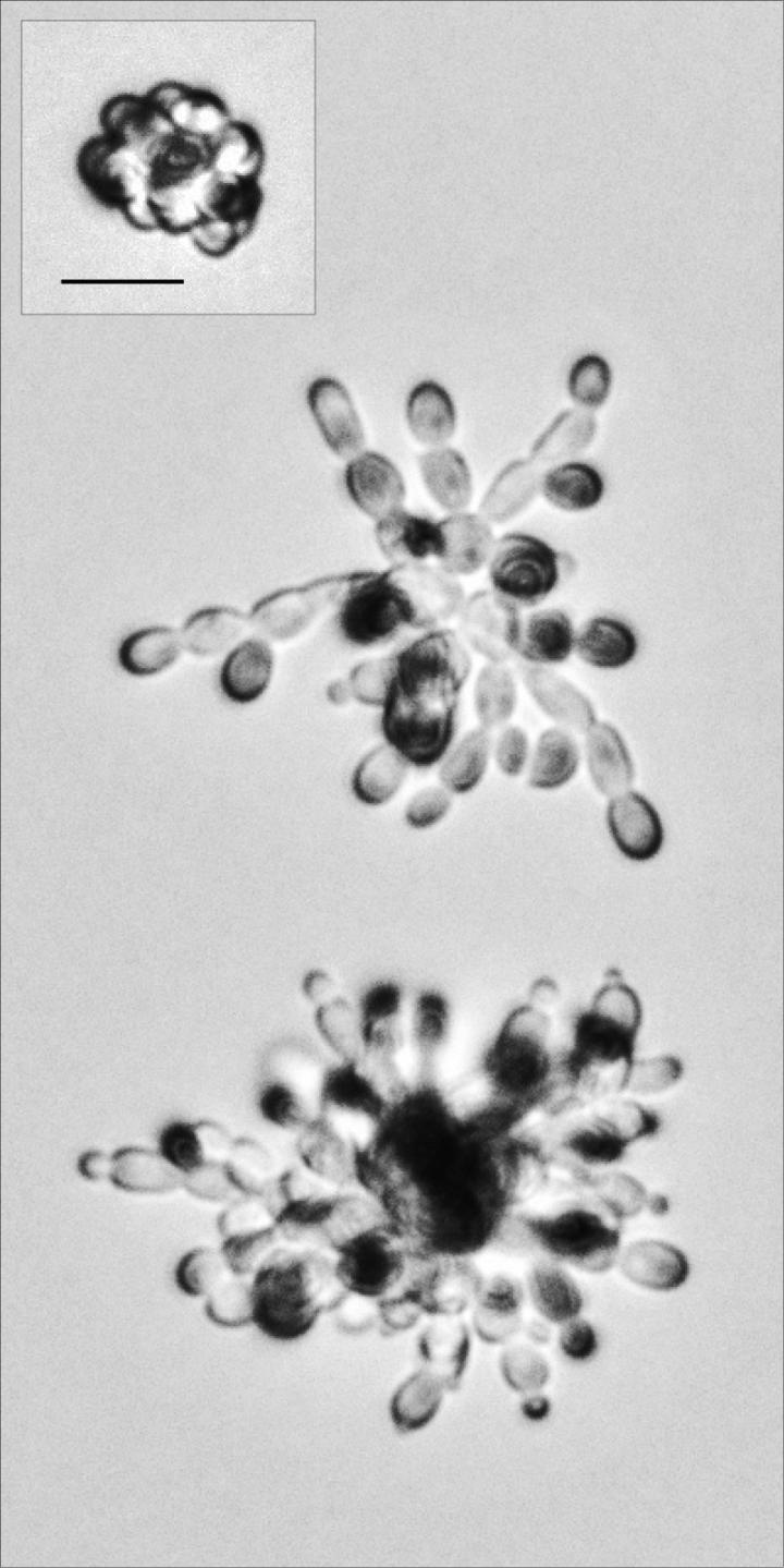 Yeast Colonies in Nutrient-Rich and Nutrient-Limited Conditions (2/2)