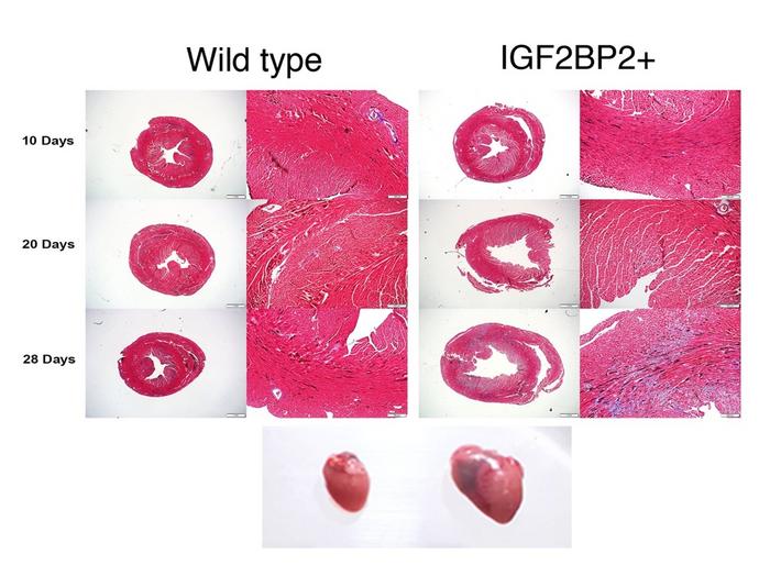 Development of dilated cardiomyopathy in mice expressing IGF2BP2