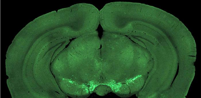 Two-photon microscopy helps researchers to observe brain mesocortical axon terminals (bright green) during a self-initiated lever-press task.