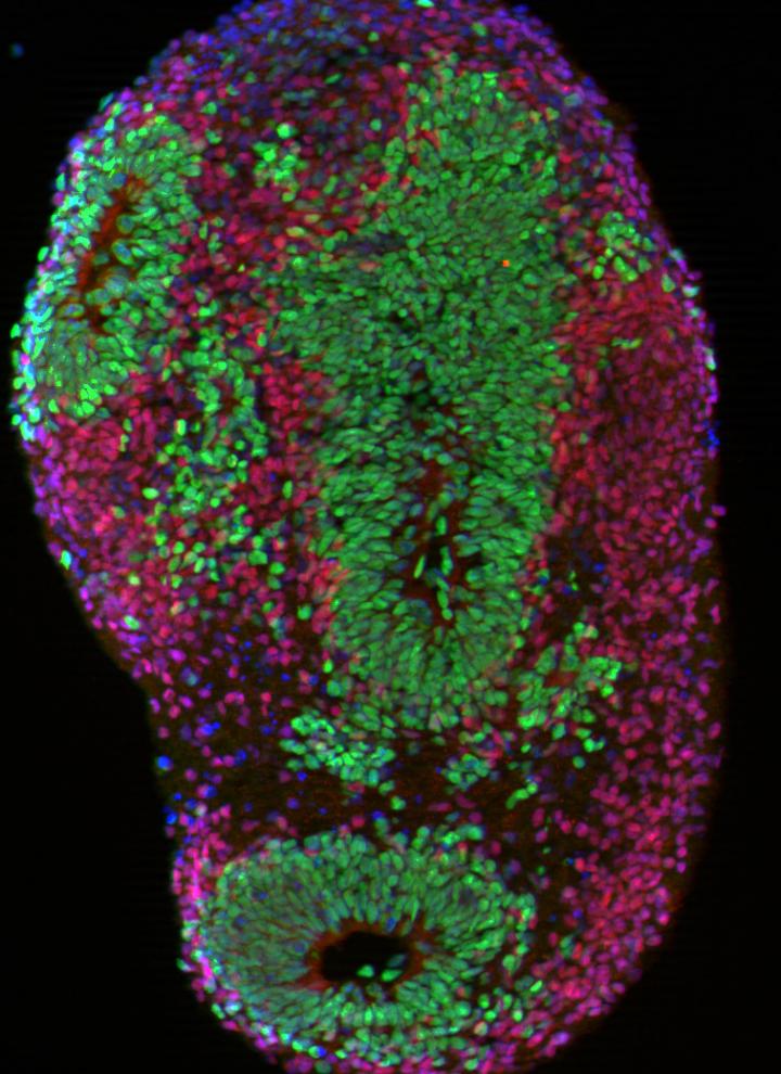 Illuminating the Brain Architecture of Neuropsychiatric Risk: The Latest from PsychENCODE (5 of 6)