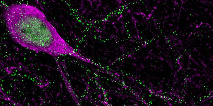 neurons in the mouse neocortex