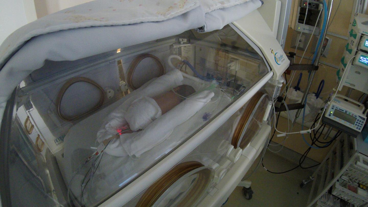 Blocking Light Improves Preemies' Survival Rates (2 of 3)