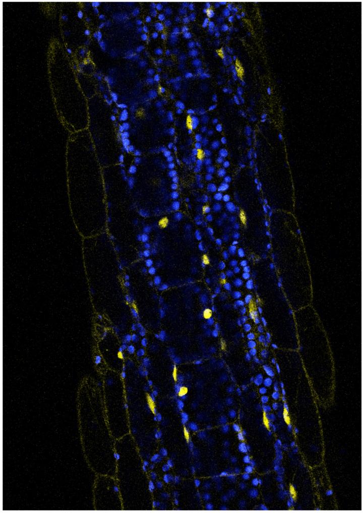 Salk Discovery of Novel Plant Growth Pathway Could Be a Boon to Agriculture