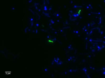 Visualizing Cells From The Candidate Phylum Kryptonia