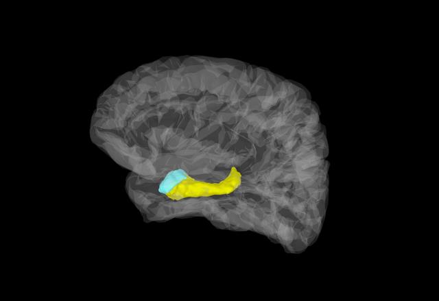 Brain Image with Amygdala and Hippocampus