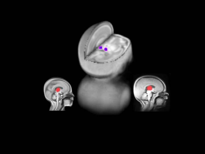 Thalamic Growth