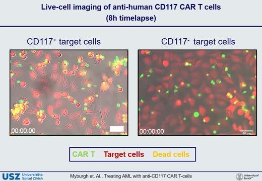 Immunotherapy with CAR T-cells
