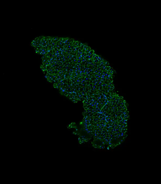 Heart biopsy tissue from a patient with COVID-19