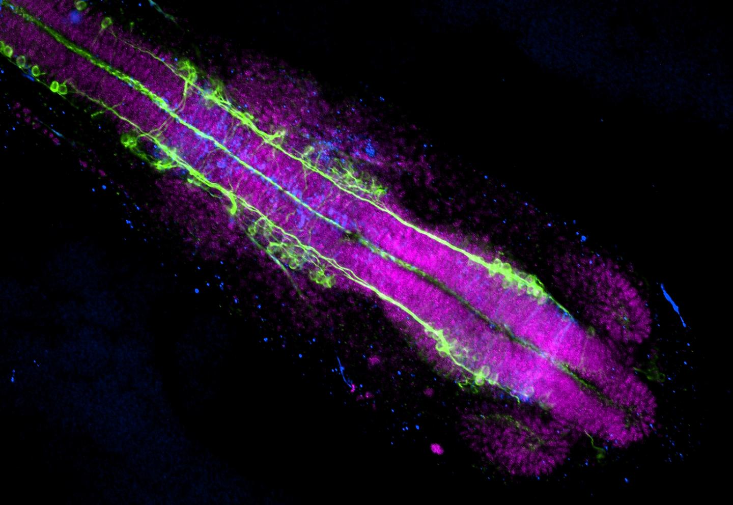 In Killifish: Diapause Protects Life From Normal Consequences of Aging (8 of 14)