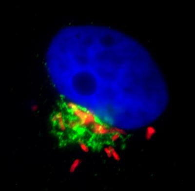<i>Campylobacter jejuni</i> Inside a Cell