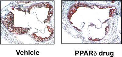 New Potential Drug Target for the Treatment of Atherosclerosis