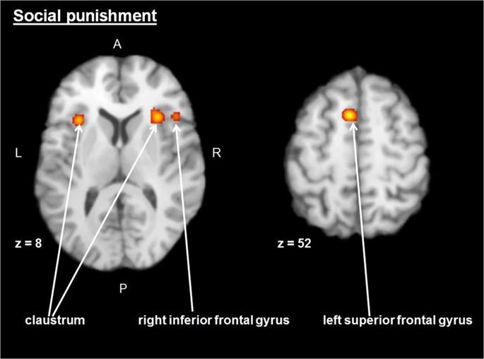 Social Punishment