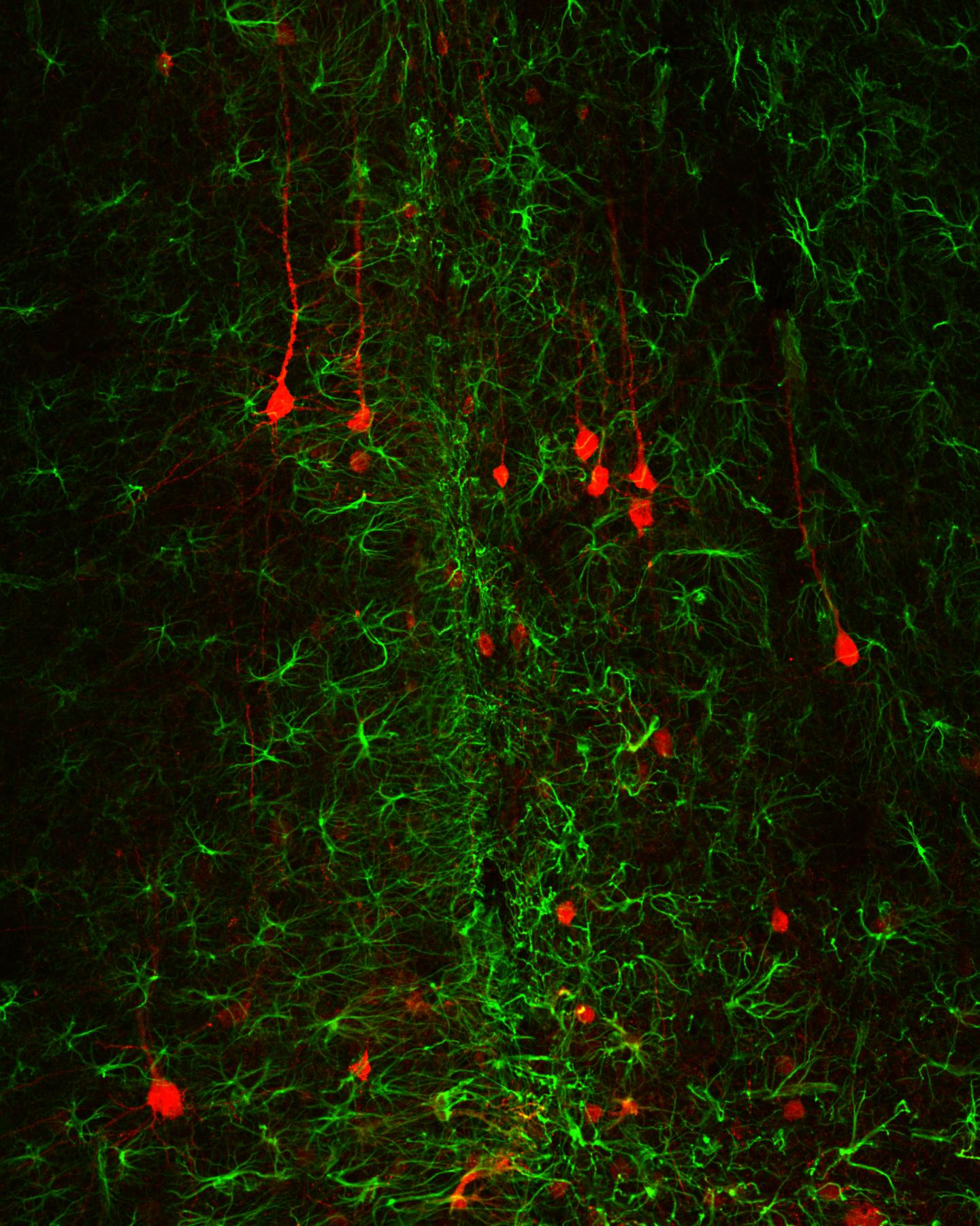 Reversal of Glial Scar Tissue Back to Neuronal Tissue Through Neuroregenerative Gene Therapy