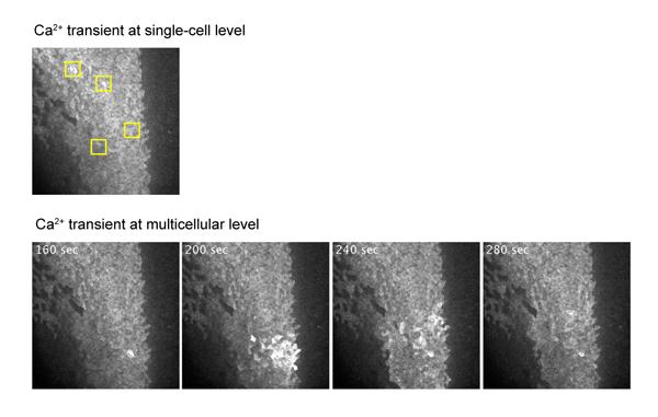 The Pattern of the Fluctuation in Intracellular Calcium Ion Concentration in the Cell Population
