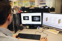 Artificial Intelligence to Improve Resolution of Brain Magnetic Resonance Imaging (1 of 2)