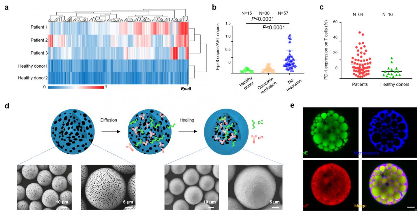 High expression of Eps8 and PD-1/PD-L1 in acute leukemia